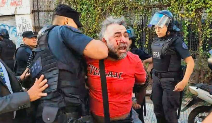  La Policía Federal agredió y detuvo a un camarógrafo de A24