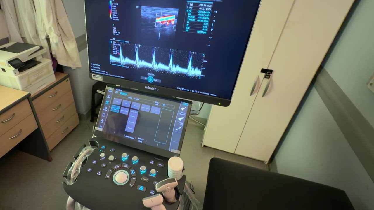 Vicente López incorporó un nuevo ecógrafo de última generación al Hospital Houssay