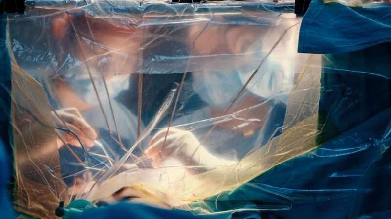 Cirugía cerebral con la paciente despierta: una intervención de alta complejidad en el Hospital de San Fernando