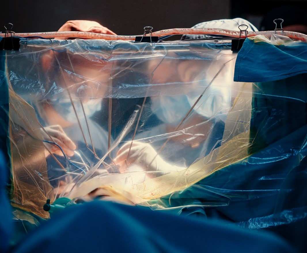Cirugía cerebral con la paciente despierta: una intervención de alta complejidad en el Hospital de San Fernando